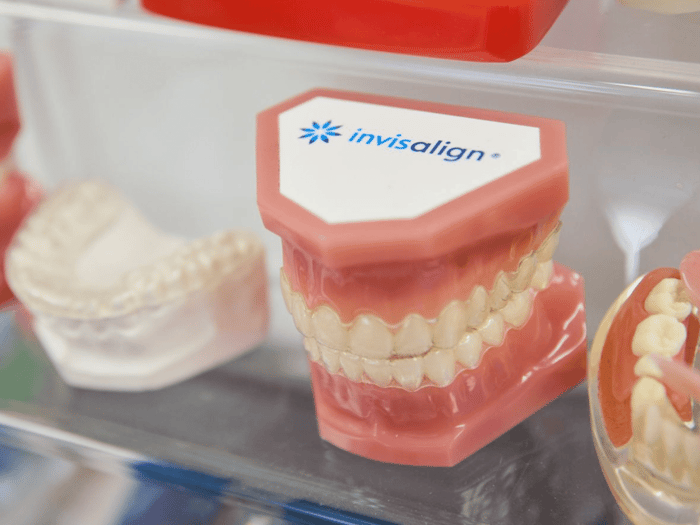 Brace-Friendly Habits That Support Smoother Orthodontic Progress