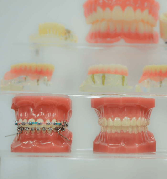 Benefits of Visiting Dental Offices That Focus on Comfort-First Treatment