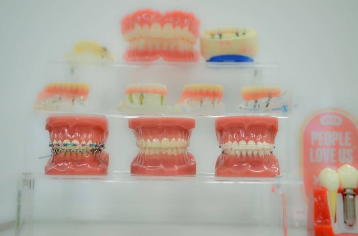 Display of dental models showing teeth, braces, and orthodontic treatments arranged on clear shelves.