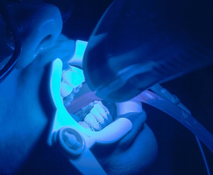 dental cleaning and checkup