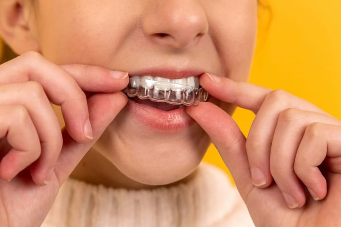 Invisalign vs Braces For Teens