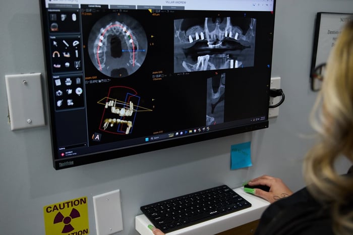 A monitor that shows someone's teeth