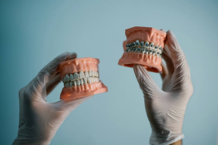 Gloved hands holding two dental models comparing natural teeth and braces treatment.