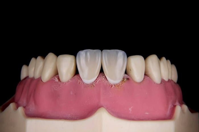 A set of bottom teeth with gums