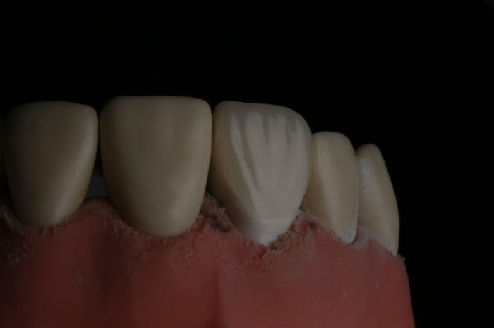A close up of the bottom part of the teeth