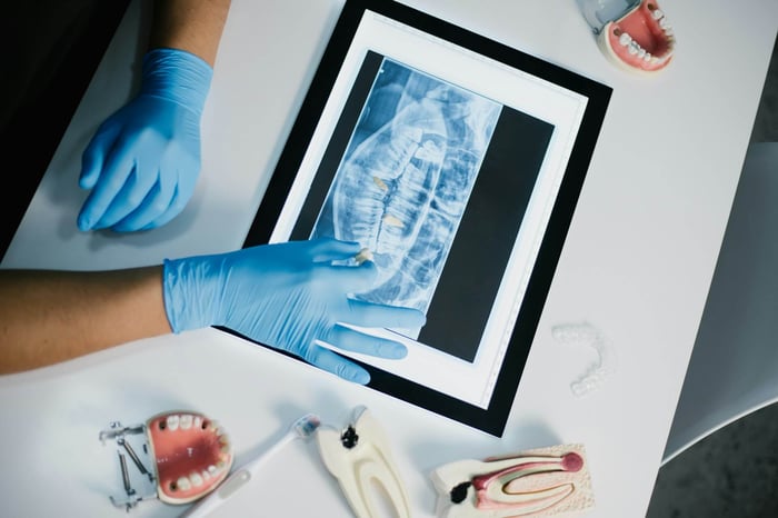 Dentist reviewing a dental X-ray on a tablet with gloved hands, surrounded by dental tools and tooth models.