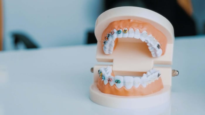Family Dentist Anaheim: Complete Care for Your Whole Family