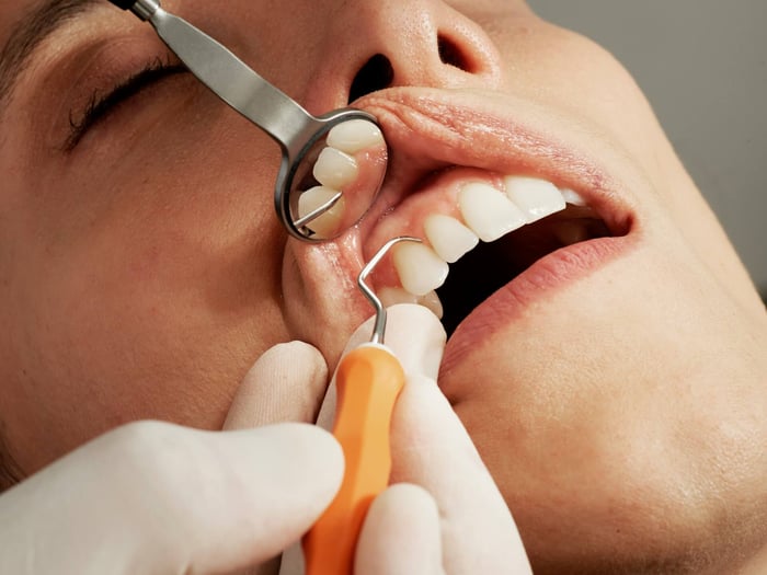 A woman being worked on by a dentist