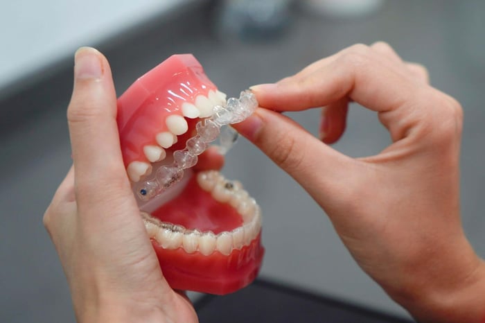 When Veneers May Help Reshape Teeth and Improve Your Smile
