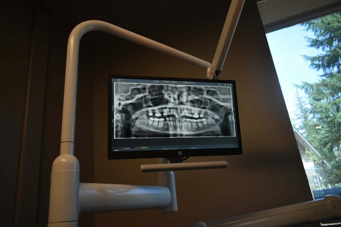 Why Does the Dentist Take X-rays