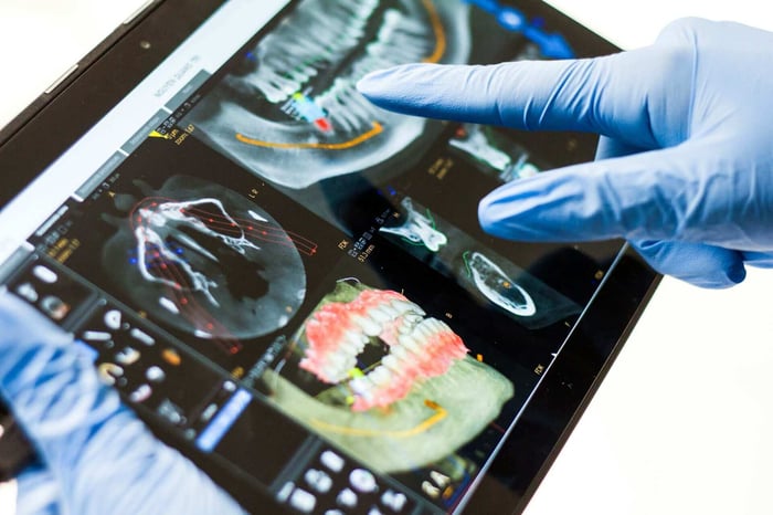 Are Dental X-Rays Safe for Children