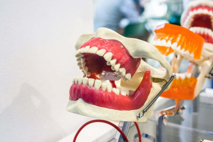 Dental model used to explain dental veneers