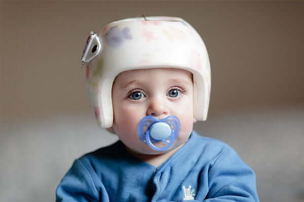 How to Choose a Special Needs Protective Helmet