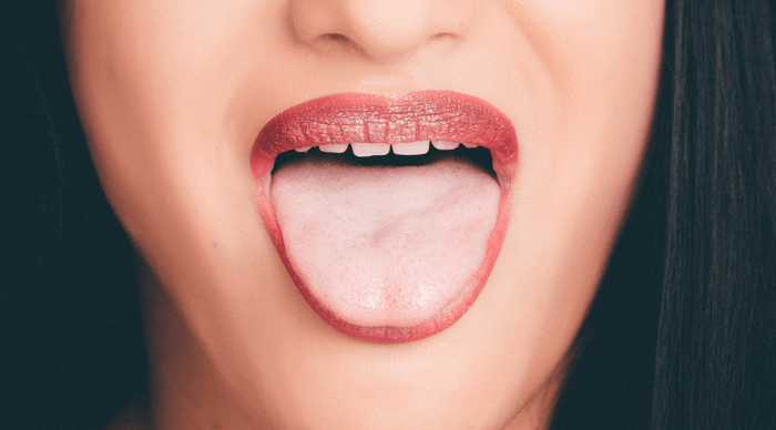 Burning Mouth Syndrome: How Histamine and Mast Cell Activation Syndrome Could Be The Cause
