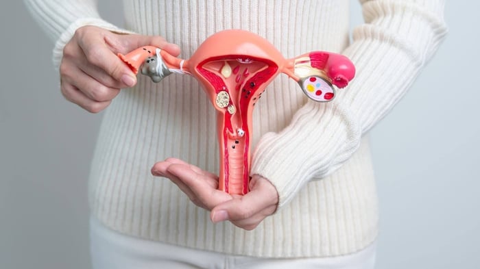 Endométriose et naturopathie : comprendre, aider à soulager et rééquilibrer naturellement