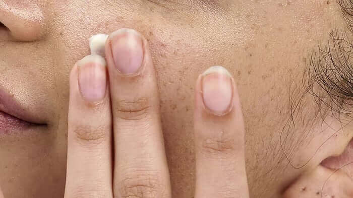Close-up of fingers gently touching facial skin, showing natural skin texture and pores typical of teenage complexion