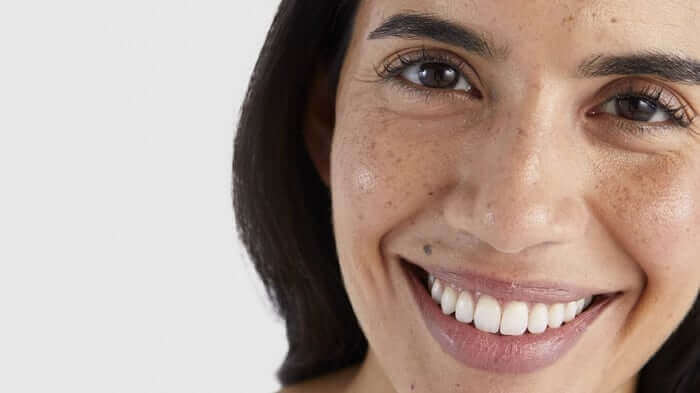 Close-up of a smiling woman with natural freckles and radiant skin showing healthy complexion and natural beauty