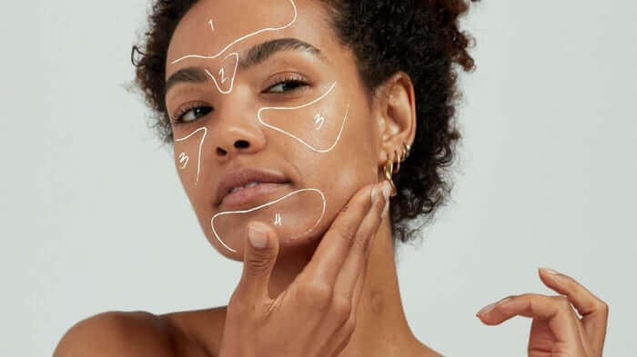 Woman with curly hair touching her face with white line drawings indicating different facial zones for acne mapping
