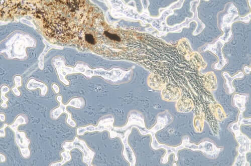 Microscopic cross-section of a parasitic worm showing internal anatomy and cellular structures in scientific detail