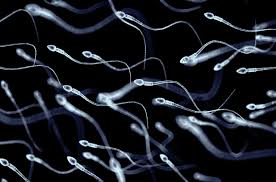 Antisperm Antibody test