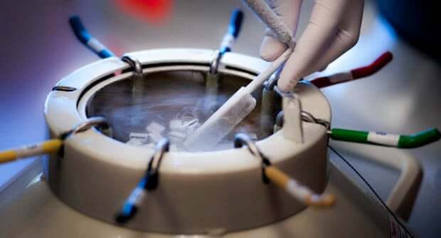 What is Sperm Freezing - Why Should I consider?