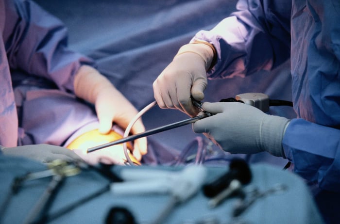 Vasectomy