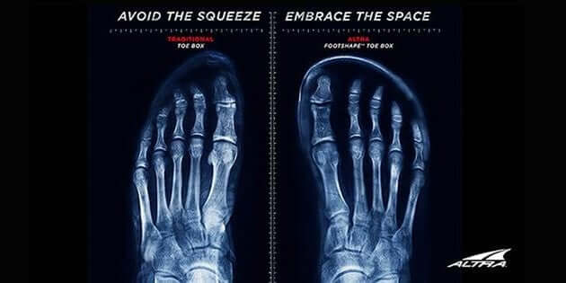 Foot-shaped shoes - who'd have ever thought about it?