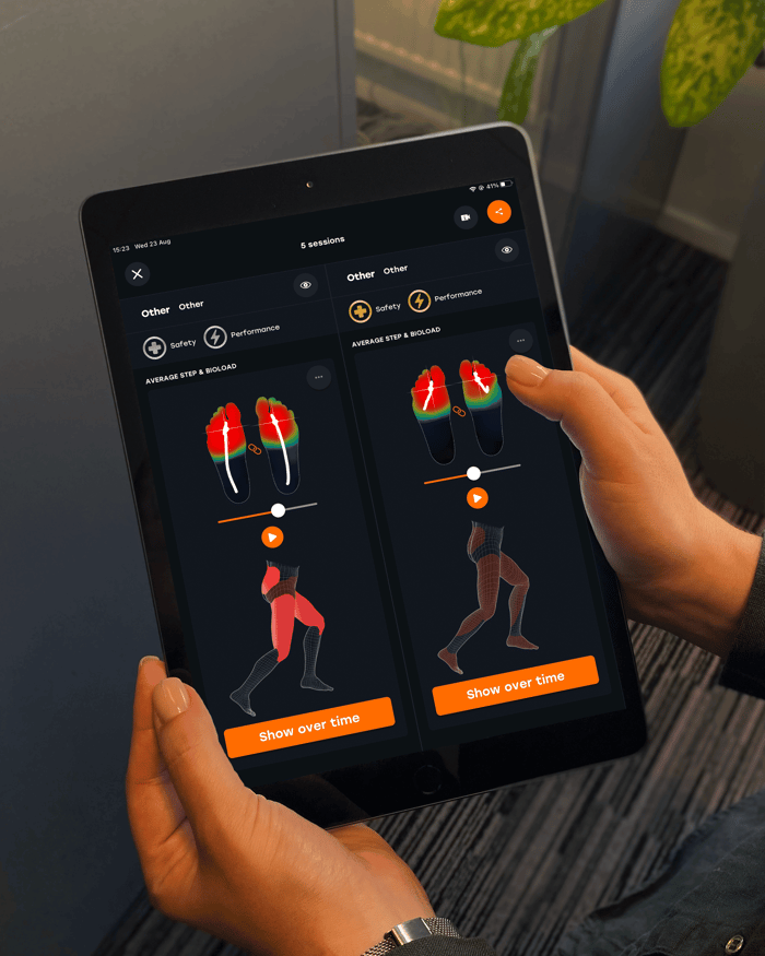 What is gait analysis and do you need it?