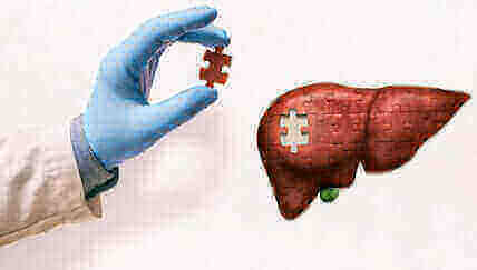 Tetrahydrocurcumin providing hepatoprotective benefits for optimal liver health
