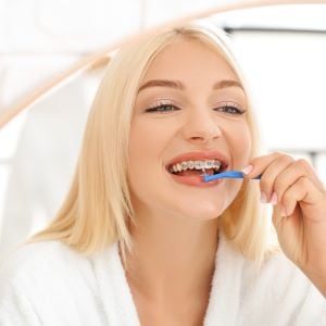 Tips to Prevent Teeth Stains with Braces