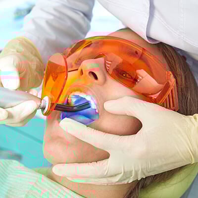 Post-Filling Tooth Pain