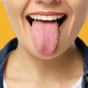 Your Tongue Says About Your Health