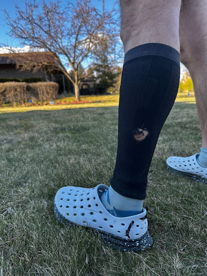 Calf compression sleeve after a running incident showing protective support