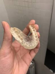 Effective Techniques to Remove Calcium Buildup from Your Teeth Night Guard
