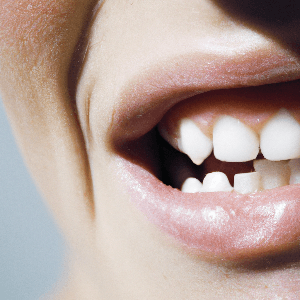 All You Need To Know About Unconsciously Clenching Your Jaw While Awake.