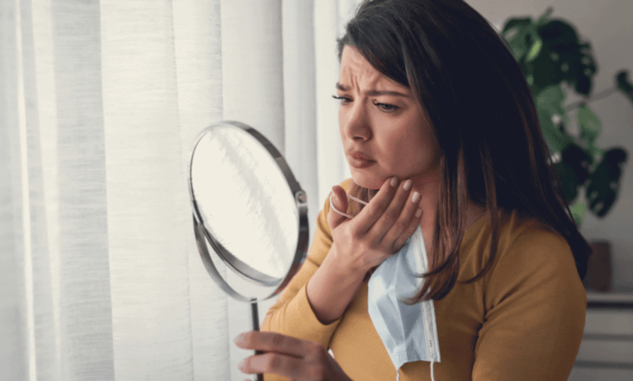 Maskne, la nuova acne da mascherina
