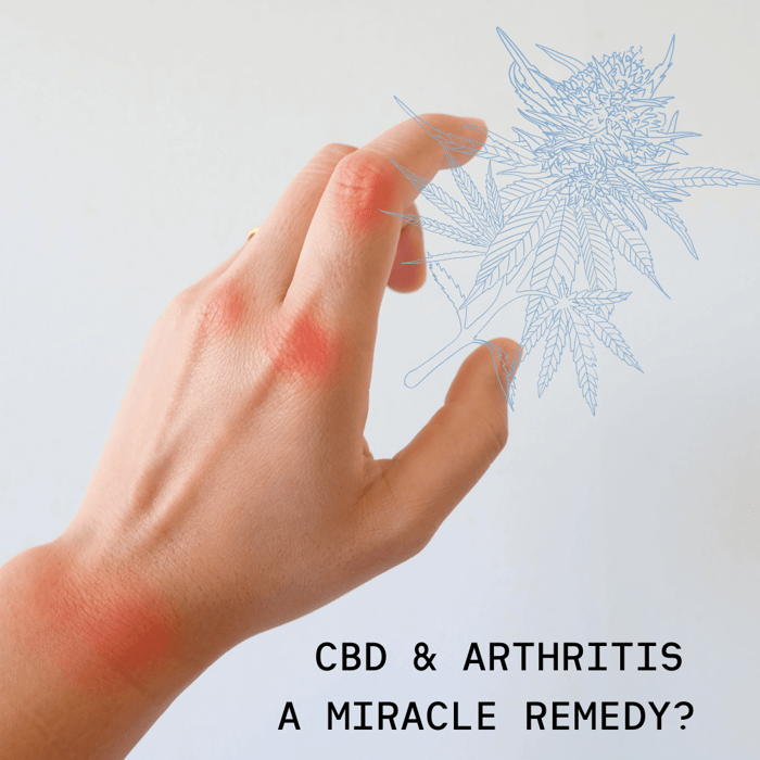 Does CBD help with Arthritis Pain and Stiffness?