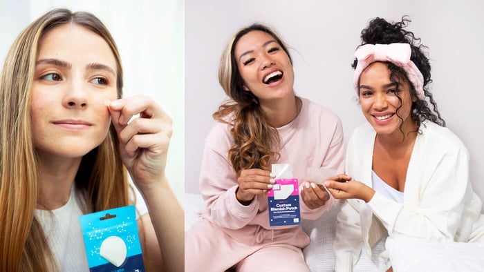 Hormonal Acne 101