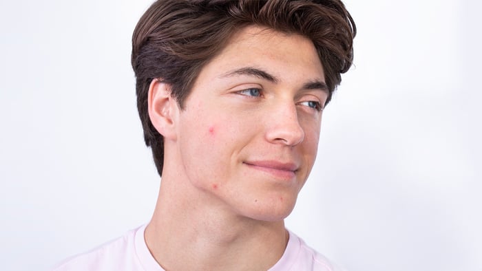 5 Ways to improve skin texture