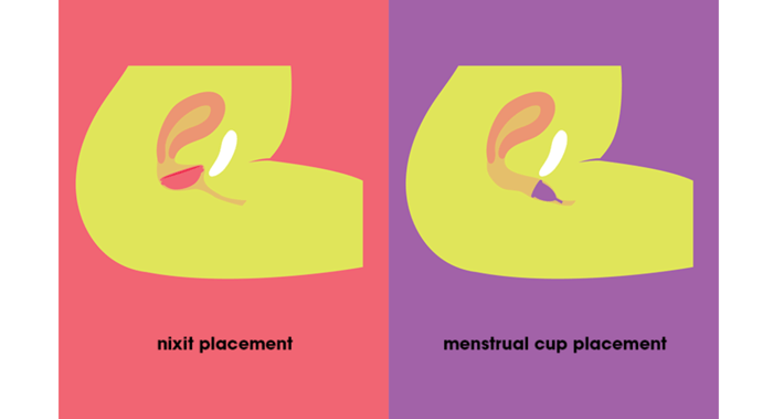 diagram of female anatomy
