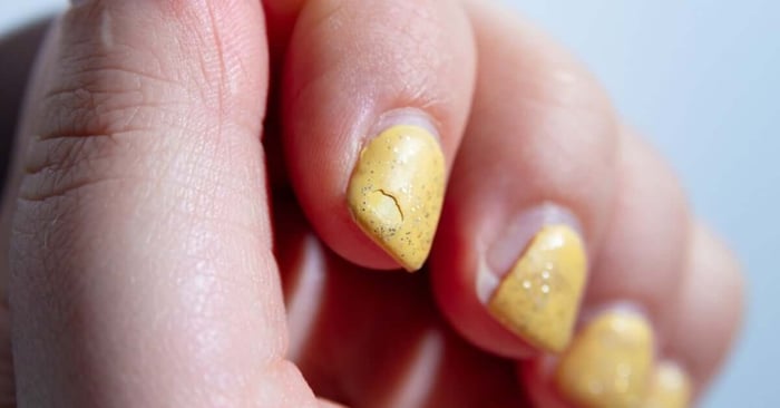 A close-up view shows a person's fingers and nails that are painted yellow. The index finger nail polish is cracked.