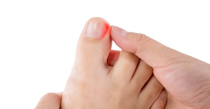 A person holding their foot in their hand and examining the big toe. Red light illuminates the toe corner to show pain.