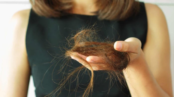 Everything You Need to Know About Alopecia