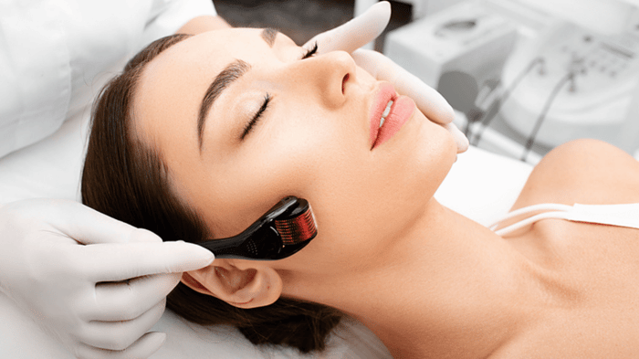 Improve Your Skin with Microneedling