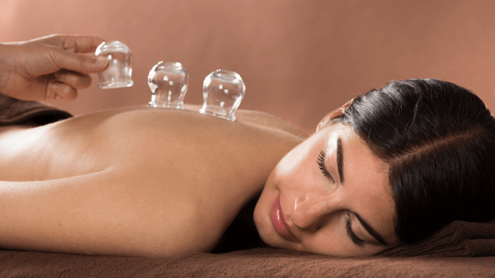 Have You Heard of Cupping Therapy? Here's Everything You Need to Know