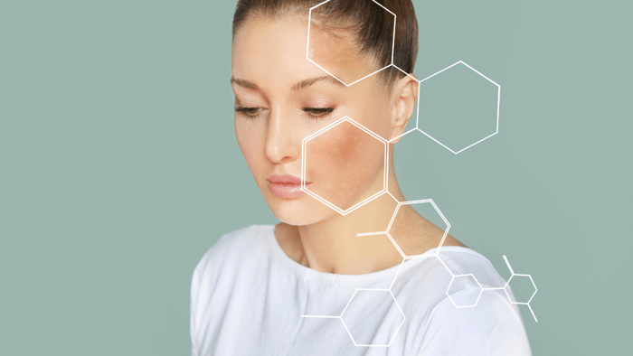 What is the skin barrier and how to protect it