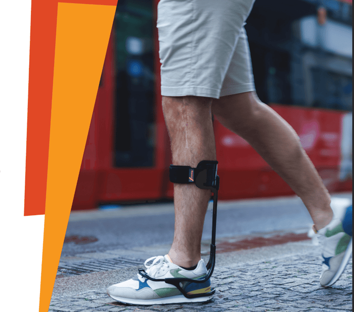 XTERN ทางเลือกใหม่สำหรับคนเท้าตก