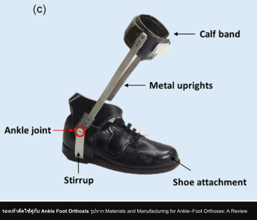 รู้จักรองเท้าตัด คืออะไร จำเป็นกับทุกคนไหม