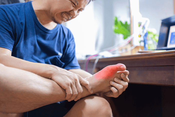 เคยรู้สึกเจ็บนิ้วเท้าแบบไม่มีเหตุผลชัดเจนไหม? อาจไม่ได้เกิดจากการชนหรือบาดเจ็บโดยตรง แต่อาจเป็นสัญญาณของปัญหาสุขภาพที่ซ่อนอยู่ ซึ่ง ภาวะเท้าแบน (Flat Feet) ก็เป็นหนึ่งในปัจจัยที่อาจส่งผลให้เกิดอาการนี้ได้