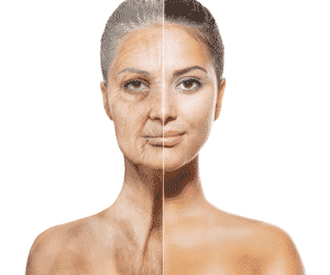 Cell mitochondria aging and epigenetic modifications in skin cells affecting GCAT gene expression